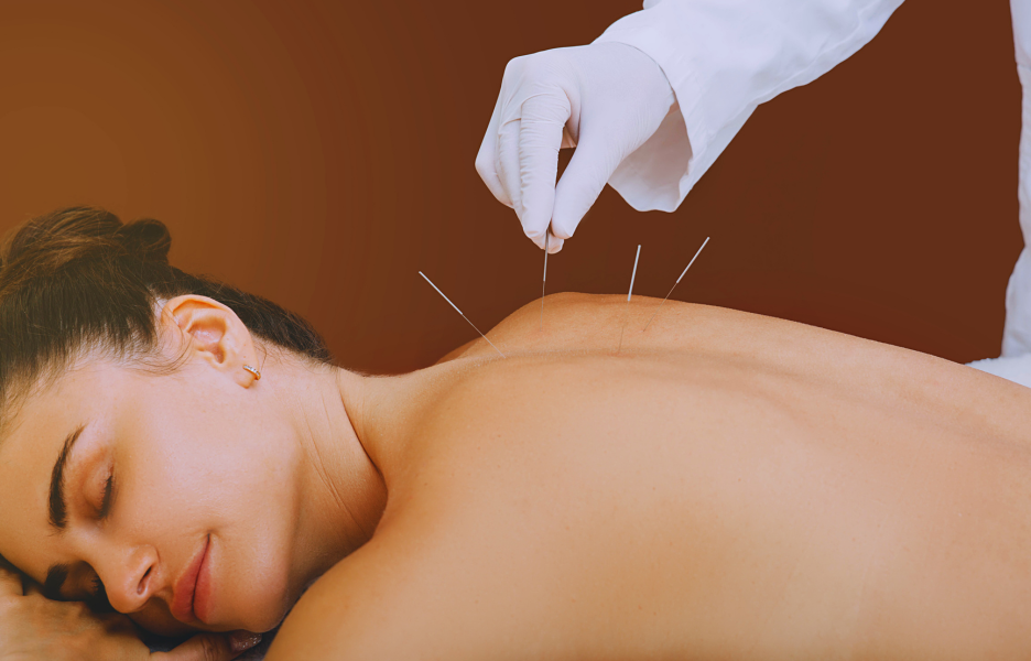 Medical Acupuncture